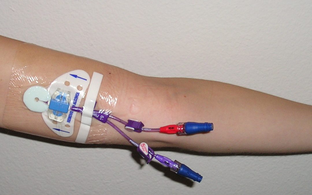 PICC-Line-1080x675