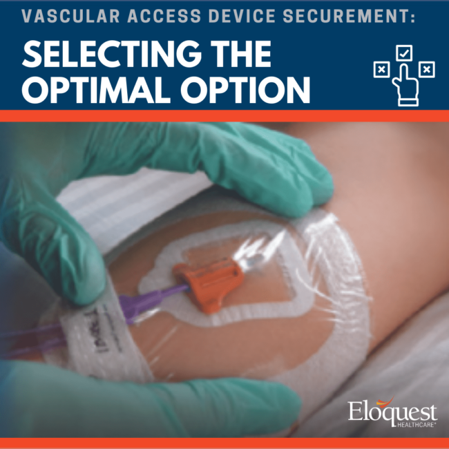 Test: Vascular Access Device Securement: Selecting the Optimal Option