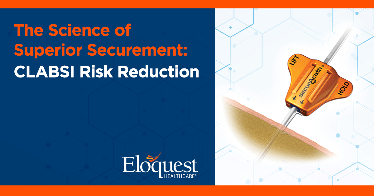 Science-of-Superior-Securement-Header_1200x630