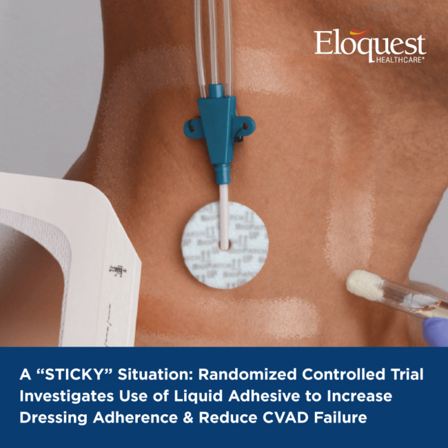 Randomized Controlled Trial Investigation Use of Liquid Adhesive to Increase Dressing Adherence & Reduce CVAD Failure